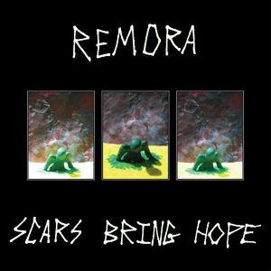 Scars Bring Hope cover