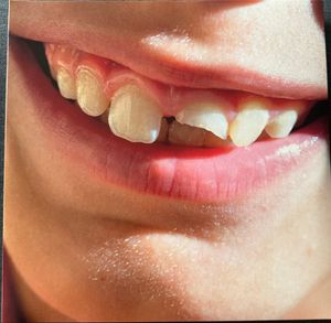 Smiling Through The Pain cover